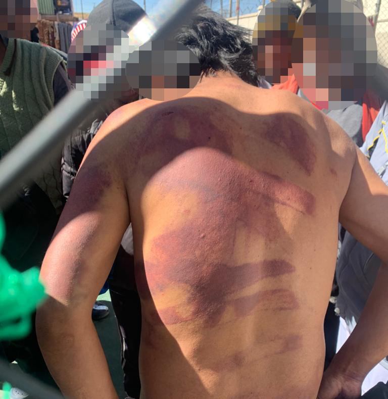 La Defensoría del Pueblo pide reforzar la seguridad interna del penal de Chonchocoro, donde 14 internos fueron brutalmente agredidos