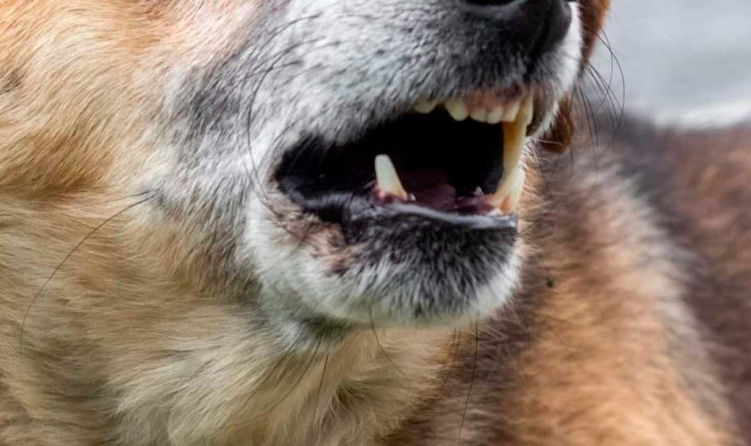 Defensoría del Pueblo gestiona intervención integral de la DNA para adolescente atacada por una jauría de perros en Sucre